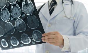 neurologists treat nerve pain