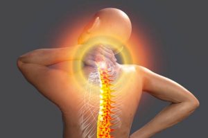 fibromyalgia treated by a neurologist